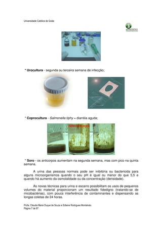 Universidade Católica de Goiás




* Urocultura - segunda ou terceira semana de infecção;




* Coprocultura - Salmonella tiphy = diarréia aguda;




 * Soro - os anticorpos aumentam na segunda semana, mas com pico na quinta
semana.

      A urina das pessoas normais pode ser inibitória ou bactericida para
alguns microorganismos quando o seu pH é igual ou menor do que 5,5 e
quando há aumento da osmolalidade ou da concentração (densidade).

      As novas técnicas para urina e escarro possibilitam os usos de pequenos
volumes do material proporcionam um resultado fidedigno (tratando-se de
micobactérias), com pouca interferência de contaminantes e dispensando as
longas coletas de 24 horas.

Profa. Cláudia Maria Duque de Souza e Edlaine Rodrigues Montalváo.
Página 7 de 87
 