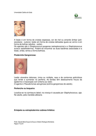 Universidade Católica de Goiás




A lesão é em forma de crostas espessas, cor de mel ou amarelo âmbar (pré-
escolares - outono); lesão em forma de crostas delicadas iguais ao verniz e em
forma de bolhas (adultos - verão).
Os agentes são o Streptococcus pyogenes (estreptococica) e o Staphylococcus
aureus (estafilodermia). Podem-se encontrar as duas bactérias associadas e a
lesão, então, temos a forma bolhosa.

Piodermite Gangrenosa:




Lesão ulcerativa dolorosa, única ou múltipla, rasa e de contornos policíclicos
que tende a aumentar na periferia. As bordas têm deslocamento frouxo da
epiderme e maceração com eritema ao redor.
O agente é Pseudomonas aeruginosa (ectima gangrenoso do adulto).

Perlenche ou boqueira:

Localiza-se na comissura labial; na criança é causada por Staphylococcus, spp.
No adulto, pela Candida albicans.




Erisipela ou estreptodermia cutânea linfática:




Profa. Cláudia Maria Duque de Souza e Edlaine Rodrigues Montalváo.
Página 77 de 87
 