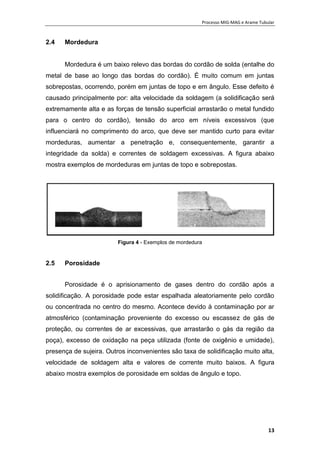Processo MIG-MAG e Arame Tubular
13
2.4 Mordedura
Mordedura é um baixo relevo das bordas do cordão de solda (entalhe do
metal de base ao longo das bordas do cordão). É muito comum em juntas
sobrepostas, ocorrendo, porém em juntas de topo e em ângulo. Esse defeito é
causado principalmente por: alta velocidade da soldagem (a solidificação será
extremamente alta e as forças de tensão superficial arrastarão o metal fundido
para o centro do cordão), tensão do arco em níveis excessivos (que
influenciará no comprimento do arco, que deve ser mantido curto para evitar
mordeduras, aumentar a penetração e, consequentemente, garantir a
integridade da solda) e correntes de soldagem excessivas. A figura abaixo
mostra exemplos de mordeduras em juntas de topo e sobrepostas.
Figura 4 - Exemplos de mordedura
2.5 Porosidade
Porosidade é o aprisionamento de gases dentro do cordão após a
solidificação. A porosidade pode estar espalhada aleatoriamente pelo cordão
ou concentrada no centro do mesmo. Acontece devido à contaminação por ar
atmosférico (contaminação proveniente do excesso ou escassez de gás de
proteção, ou correntes de ar excessivas, que arrastarão o gás da região da
poça), excesso de oxidação na peça utilizada (fonte de oxigênio e umidade),
presença de sujeira. Outros inconvenientes são taxa de solidificação muito alta,
velocidade de soldagem alta e valores de corrente muito baixos. A figura
abaixo mostra exemplos de porosidade em soldas de ângulo e topo.
 