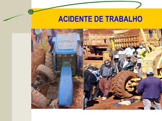 ACIDENTE DE TRABALHO
 