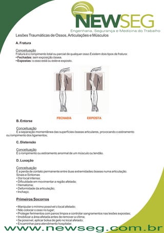 www.newseg.com.br
LesõesTraumáticas de Ossos,Articulações e Músculos
A. Fratura
Conceituação
Fratura é o rompimento total ou parcial de qualquer osso.Existem dois tipos de fratura:
sem exposição óssea.
o osso está ou esteve exposto.
Fechadas:
• Expostas:
•
B. Entorse
C. Distensão
D. Luxação
Conceituação
Conceituação
Conceituação
É a separação momentânea das superfícies ósseas articulares, provocando o estiramento
ou rompimento dos ligamentos;
É a perda de contato permanente entre duas extremidades ósseas numa articulação.
Sinais e Sintomas
• Dor local intensa;
• Dificuldade em movimentar a região afetada;
• Hematoma;
• Deformidade da articulação;
• Inchaço;
• Manipular o mínimo possível o local afetado;
• Não colocar o osso no lugar;
• Proteger ferimentos com panos limpos e controlar sangramentos nas lesões expostas;
• Imobilizar a área afetada antes de remover a vítima;
• Se possível, aplicar bolsa de gelo no local afetado;
• Encaminhar para atendimento hospitalar.
É o rompimento ou estiramento anormal de um músculo ou tendão.
Primeiros Socorros
 