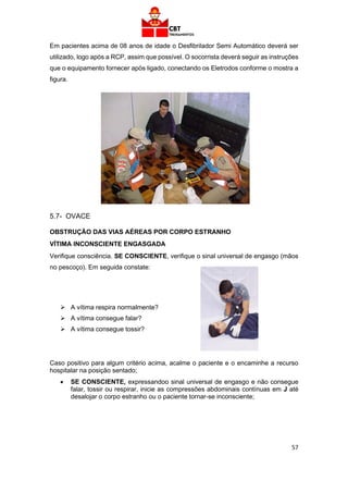 57
Em pacientes acima de 08 anos de idade o Desfibrilador Semi Automático deverá ser
utilizado, logo após a RCP, assim que possível. O socorrista deverá seguir as instruções
que o equipamento fornecer após ligado, conectando os Eletrodos conforme o mostra a
figura.
5.7- OVACE
OBSTRUÇÃO DAS VIAS AÉREAS POR CORPO ESTRANHO
VÍTIMA INCONSCIENTE ENGASGADA
Verifique consciência. SE CONSCIENTE, verifique o sinal universal de engasgo (mãos
no pescoço). Em seguida constate:
➢ A vítima respira normalmente?
➢ A vítima consegue falar?
➢ A vítima consegue tossir?
Caso positivo para algum critério acima, acalme o paciente e o encaminhe a recurso
hospitalar na posição sentado;
• SE CONSCIENTE, expressandoo sinal universal de engasgo e não consegue
falar, tossir ou respirar, inicie as compressões abdominais contínuas em J até
desalojar o corpo estranho ou o paciente tornar-se inconsciente;
 