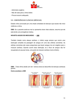 61
- Administre oxigênio;
- Não dê nada para a vítima beber;
- Procure socorro adequado.
5.9 - EMERGÊNCIAS CLÍNICAS (MÉDICAS)
Estado crítico provocado por uma ampla variedade de doenças cuja causas não inclui
violência a vítima.
OBS: Se o paciente sente-se mal ou apresenta sinais vitais atípicos, assuma que ele
esta tendo uma emergência médica.
INFARTO AGUDO DO MIOCARDIO - IAM
Também tratado como ataque cardíaco, o infarto surge sempre que ocorre uma
obstrução completa da passagem de sangue em uma das artérias coronárias. As
artérias coronárias são vasos sanguíneos que levam sangue rico em oxigênio para o
músculo cardíaco. Quando ocorre essa obstrução, se o fluxo de sangue não for
recuperado em poucas horas, uma parte do músculo cardíaco morre (infarto).
OBS: “Toda vítima adulta com dor torácica deve-se desconfiar de doenças cardíacas
graves.”
Como acontece o IAM:
 