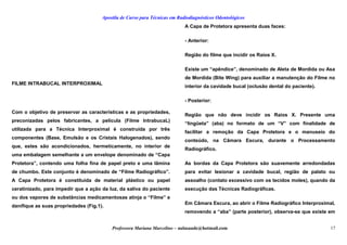 Apostila de Curso para Técnicas em Radiodiagnósticos Odontológicos
FILME INTRABUCAL INTERPROXIMAL
Com o objetivo de preservar as características e as propriedades,
preconizadas pelos fabricantes, a película (Filme IntrabucaL)
utilizada para a Técnica Interproximal é construída por três
componentes (Base, Emulsão e os Cristais Halogenados), sendo
que, estes são acondicionados, hermeticamente, no interior de
uma embalagem semelhante a um envelope denominado de “Capa
Protetora”, contendo uma folha fina de papel preto e uma lâmina
de chumbo. Este conjunto é denominado de “Filme Radiográfico”.
A Capa Protetora é constituída de material plástico ou papel
ceratinizado, para impedir que a ação da luz, da saliva do paciente
ou dos vapores de substâncias medicamentosas atinja o “Filme” e
danifique as suas propriedades (Fig.1).
A Capa de Protetora apresenta duas faces:
- Anterior:
Região do filme que incidir os Raios X.
Existe um “apêndice”, denominado de Aleta de Mordida ou Asa
de Mordida (Bite Wing) para auxiliar a manutenção do Filme no
interior da cavidade bucal (oclusão dental do paciente).
- Posterior:
Região que não deve incidir os Raios X. Presente uma
“lingüeta” (aba) no formato de um “V” com finalidade de
facilitar a remoção da Capa Protetora e o manuseio do
conteúdo, na Câmara Escura, durante o Processamento
Radiográfico.
As bordas da Capa Protetora são suavemente arredondadas
para evitar lesionar a cavidade bucal, região de palato ou
assoalho (contato excessivo com os tecidos moles), quando da
execução das Técnicas Radiográficas.
Em Câmara Escura, ao abrir o Filme Radiográfico Interproximal,
removendo a “aba” (parte posterior), observa-se que existe em
Professora Mariana Marcelino – aulasaude@hotmail.com 17
 