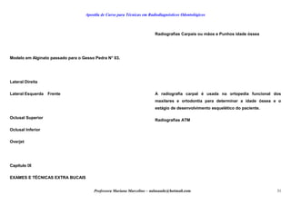 Apostila de Curso para Técnicas em Radiodiagnósticos Odontológicos
Modelo em Alginato passado para o Gesso Pedra N° 03.
Lateral Direita
Lateral Esquerda Frente
Oclusal Superior
Oclusal Inferior
Overjet
Capítulo IX
EXAMES E TÉCNICAS EXTRA BUCAIS
Radiografias Carpais ou mãos e Punhos idade óssea
A radiografia carpal é usada na ortopedia funcional dos
maxilares e ortodontia para determinar a idade óssea e o
estágio de desenvolvimento esquelético do paciente.
Radiografias ATM
Professora Mariana Marcelino – aulasaude@hotmail.com 31
 
