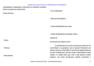 Apostila de Curso para Técnicas em Radiodiagnósticos Odontológicos
possibilitando o diagnóstico e tratamento em ortodontia, ortopedia
facial e cirurgia buco maxilo facial.
Outras Técnicas
- Towne
- 45 Graus
- Axial de Nariz
- P.A. de Mandíbula
- Seios da Face (Water’s)
- Lateral de Mandíbula para Corpo
- Lateral de Mandíbula para Ângulo e Ramo
Capítulo IX
As doenças que atingem a boca
O revestimento de uma boca sã (mucosa bucal) é de cor
avermelhada e as gengivas, que se ajustam firmemente aos
dentes, são de cor mais pálida. O céu da boca (palato) divide-se
em dois. O palato duro, que tem cristas e está situado na parte
anterior, e o palato mole, que é liso e está situado na parte
posterior. Um bordo húmido-seco delimita claramente a
Professora Mariana Marcelino – aulasaude@hotmail.com 35
 