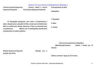 Apostila de Curso para Técnicas em Radiodiagnósticos Odontológicos
Incisivos Centrais Superiores Incisivo Lateral e Canino
Superiores Esquerdo Pré-molares Superiores Esquerdo
14 radiografias periapicais, sem cortar a incisal/oclusal e
ápice, atenção para a posição do filme, picote para incisal/oclusal,
filme na vertical para dentes anteriores e filme na horizontal para
os posteriores. Bateria com 14 Radiografias devidamente
armazenados na moldura plástica:
Molares Superiores Esquerdo Atenção com a
posição dos filmes
Processamento do filme
radiográfico:
1. Revelador
2. Água
3. Fixador
Caixa de processamento radiográfico
500ml Solução fixadora Coletor + fixador por 10
minutos
Coletor universal + água por 10 minutos
Professora Mariana Marcelino – aulasaude@hotmail.com 41
 