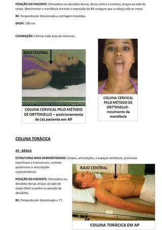 101
POSIÇÃO DO PACIENTE: Ortostática ou decúbito dorsal, dorso contra a estativa, braços ao lado do
corpo. Movimentar a mandíbula durante a exposição do RX assegure que a cabeça não se mova.
RC: Perpendicular direcionado a cartilagem tireóidea.
DFOFI: 100 cm.
COLIMAÇÃO: Colimar toda área de interesse.
COLUNA TORÁCICA
AP - BÁSICA
ESTRUTURAS MAIS DEMONSTRADAS: Corpos, articulações, e espaços vertebrais, processos
espinhosos e transversais, costelas
posteriores e articulações
costovertebrais.
POSIÇÃO DO PACIENTE: Ortostática ou
decúbito dorsal, braços ao lado do
corpo (fletir o joelho na posição de
decúbito).
RC: Perpendicular direcionado a T7.
 