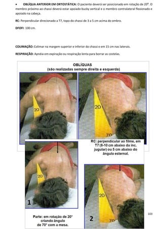 103
 OBLÍQUA ANTERIOR EM ORTOSTÁTICA: O paciente deverá ser posicionado em rotação de 20⁰. O
membro próximo ao chassi deverá estar apoiado bucky vertical e o membro contralateral flexionado e
apoiado na cabeça.
RC: Perpendicular direcionado a T7, topo do chassi de 3 a 5 cm acima do ombro.
DFOFI: 100 cm.
COLIMAÇÃO: Colimar na margem superior e inferior do chassi e em 15 cm nas laterais.
RESPIRAÇÃO: Apnéia em expiração ou respiração lenta para borrar as costelas.
 