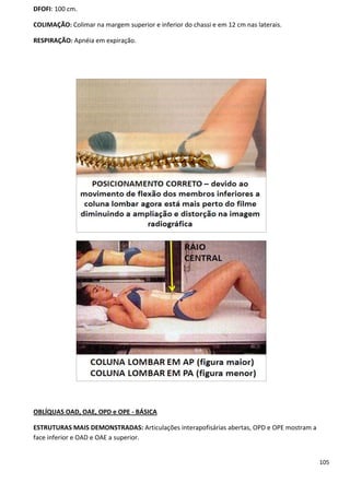 105
DFOFI: 100 cm.
COLIMAÇÃO: Colimar na margem superior e inferior do chassi e em 12 cm nas laterais.
RESPIRAÇÃO: Apnéia em expiração.
OBLÍQUAS OAD, OAE, OPD e OPE - BÁSICA
ESTRUTURAS MAIS DEMONSTRADAS: Articulações interapofisárias abertas, OPD e OPE mostram a
face inferior e OAD e OAE a superior.
 