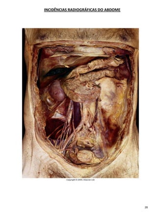 28
INCIDÊNCIAS RADIOGRÁFICAS DO ABDOME
 