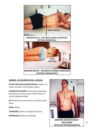 30
ABDOME - AP EM ORTOSTÁTICA - ESPECIAL
ESTRUTURAS MAIS DEMONSTRADAS: Fígado, rins,
massas anormais, níveis líquidos e gases.
POSIÇÃO DO PACIENTE: Em pé, pernas afastadas,
face posterior contra o bucky. Topo do filme ao
nível do apêndice xifóide.
RC: Perpendicular direcionado ao nível das cristas
ilíacas.
DFOFI: 100 cm.
COLIMAÇÃO: Colimar as margens do chassi.
RESPIRAÇÃO: Apnéia em expiração.
 