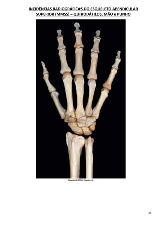 33
INCIDÊNCIAS RADIOGRÁFICAS DO ESQUELETO APENDICULAR
SUPERIOR (MMSS) – QUIRODÁTILOS, MÃO e PUNHO
 