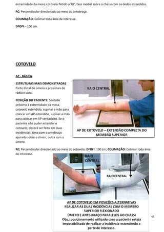 47
extremidade da mesa, cotovelo fletido a 90°, face medial sobre o chassi com os dedos estendidos.
RC: Perpendicular direcionado ao meio do antebraço.
COLIMAÇÃO: Colimar toda área de interesse.
DFOFI – 100 cm.
COTOVELO
AP - BÁSICA
ESTRUTURAS MAIS DEMONSTRADAS
Parte distal do úmero e proximais de
rádio e ulna.
POSIÇÃO DO PACIENTE: Sentado
próximo à extremidade da mesa,
cotovelo estendido, supinar a mão para
colocar em AP estendido, supinar a mão
para colocar em AP verdadeiro. Se o
paciente não puder estender o
cotovelo, deverá ser feito em duas
incidências. Uma com o antebraço
apoiado sobre o chassi, outra com o
úmero.
RC: Perpendicular direcionado ao meio do cotovelo; DFOFI: 100 cm; COLIMAÇÃO: Colimar toda área
de interesse.
 