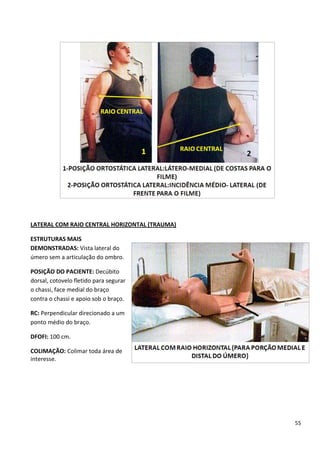 55
LATERAL COM RAIO CENTRAL HORIZONTAL (TRAUMA)
ESTRUTURAS MAIS
DEMONSTRADAS: Vista lateral do
úmero sem a articulação do ombro.
POSIÇÃO DO PACIENTE: Decúbito
dorsal, cotovelo fletido para segurar
o chassi, face medial do braço
contra o chassi e apoio sob o braço.
RC: Perpendicular direcionado a um
ponto médio do braço.
DFOFI: 100 cm.
COLIMAÇÃO: Colimar toda área de
interesse.
 