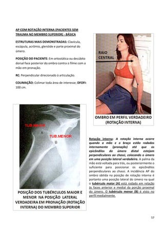 57
AP COM ROTAÇÃO INTERNA (PACIENTES SEM
TRAUMA NO MEMBRO SUPERIOR) - BÁSICA
ESTRUTURAS MAIS DEMONSTRADAS: Clavícula,
escápula, acrômio, glenóide e parte proximal do
úmero.
POSIÇÃO DO PACIENTE: Em ortostática ou decúbito
dorsal face posterior do ombro contra o filme com a
mão em pronação.
RC: Perpendicular direcionado à articulação.
COLIMAÇÃO: Colimar toda área de interesse; DFOFI:
100 cm.
Rotação interna: A rotação interna ocorre
quando a mão e o braço estão rodados
internamente (pronação) até que os
epicôndilos do úmero distal estejam
perpendiculares ao chassi, colocando o úmero
em uma posição lateral verdadeira. A palma da
mão está voltada para trás, ou posteriormente o
suficiente para posicionar os epicôndilos
perpendiculares ao chassi. A incidência AP do
ombro obtida na posição de rotação interna é
portanto uma posição lateral do úmero na qual
o tubérculo maior (A) está rodado em relação
às faces anterior e medial da porção proximal
do úmero. O tubérculo menor (B) é visto no
perfil medialmente.
 