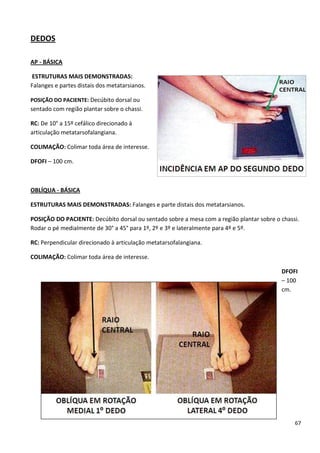 67
DEDOS
AP - BÁSICA
ESTRUTURAS MAIS DEMONSTRADAS:
Falanges e partes distais dos metatarsianos.
POSIÇÃO DO PACIENTE: Decúbito dorsal ou
sentado com região plantar sobre o chassi.
RC: De 10° a 15º cefálico direcionado à
articulação metatarsofalangiana.
COLIMAÇÃO: Colimar toda área de interesse.
DFOFI – 100 cm.
OBLÍQUA - BÁSICA
ESTRUTURAS MAIS DEMONSTRADAS: Falanges e parte distais dos metatarsianos.
POSIÇÃO DO PACIENTE: Decúbito dorsal ou sentado sobre a mesa com a região plantar sobre o chassi.
Rodar o pé medialmente de 30° a 45° para 1º, 2º e 3º e lateralmente para 4º e 5º.
RC: Perpendicular direcionado à articulação metatarsofalangiana.
COLIMAÇÃO: Colimar toda área de interesse.
DFOFI
– 100
cm.
 