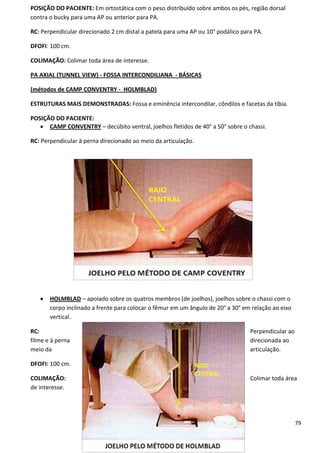 79
POSIÇÃO DO PACIENTE: Em ortostática com o peso distribuído sobre ambos os pés, região dorsal
contra o bucky para uma AP ou anterior para PA.
RC: Perpendicular direcionado 2 cm distal a patela para uma AP ou 10° podálico para PA.
DFOFI: 100 cm.
COLIMAÇÃO: Colimar toda área de interesse.
PA AXIAL (TUNNEL VIEW) - FOSSA INTERCONDILIANA - BÁSICAS
(métodos de CAMP CONVENTRY - HOLMBLAD)
ESTRUTURAS MAIS DEMONSTRADAS: Fossa e eminência intercondilar, côndilos e facetas da tíbia.
POSIÇÃO DO PACIENTE:
 CAMP CONVENTRY – decúbito ventral, joelhos fletidos de 40° a 50° sobre o chassi.
RC: Perpendicular à perna direcionado ao meio da articulação.
 HOLMBLAD – apoiado sobre os quatros membros (de joelhos), joelhos sobre o chassi com o
corpo inclinado a frente para colocar o fêmur em um ângulo de 20° a 30° em relação ao eixo
vertical.
RC: Perpendicular ao
filme e à perna direcionada ao
meio da articulação.
DFOFI: 100 cm.
COLIMAÇÃO: Colimar toda área
de interesse.
 