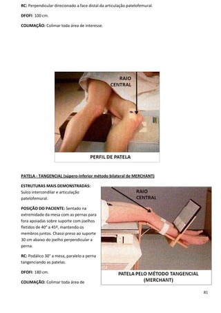 81
RC: Perpendicular direcionado a face distal da articulação patelofemural.
DFOFI: 100 cm.
COLIMAÇÃO: Colimar toda área de interesse.
PATELA - TANGENCIAL (súpero-inferior método bilateral de MERCHANT)
ESTRUTURAS MAIS DEMONSTRADAS:
Sulco intercondilar e articulação
patelofemural.
POSIÇÃO DO PACIENTE: Sentado na
extremidade da mesa com as pernas para
fora apoiadas sobre suporte com joelhos
fletidos de 40° a 45º, mantendo os
membros juntos. Chassi preso ao suporte
30 cm abaixo do joelho perpendicular a
perna.
RC: Podálico 30° a mesa, paralelo a perna
tangenciando as patelas.
DFOFI: 180 cm.
COLIMAÇÃO: Colimar toda área de
 