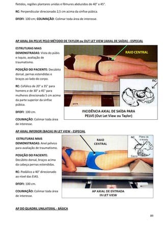 89
fletidos, regiões plantares unidas e fêmures abduzidos de 40° a 45°.
RC: Perpendicular direcionado 2,5 cm acima da sínfise púbica.
DFOFI: 100 cm; COLIMAÇÃO: Colimar toda área de interesse.
AP AXIAL DA PELVE PELO MÉTODO DE TAYLOR ou OUT LET VIEW (AXIAL DE SAÍDA) - ESPECIAL
ESTRUTURAS MAIS
DEMONSTRADAS: Vista do púbis
e ísquio, avaliação de
traumatismo.
POSIÇÃO DO PACIENTE: Decúbito
dorsal, pernas estendidas e
braços ao lado do corpo.
RC: Cefálico de 20° a 35° para
homens e de 30° a 45° para
mulheres direcionado 5 cm acima
da parte superior da sínfise
púbica.
DFOFI: 100 cm.
COLIMAÇÃO: Colimar toda área
de interesse.
AP AXIAL INFERIOR (BACIA) IN LET VIEW - ESPECIAL
ESTRUTURAS MAIS
DEMONSTRADAS: Anel pélvico
para avaliação de traumatismo.
POSIÇÃO DO PACIENTE:
Decúbito dorsal, braços acima
da cabeça pernas estendidas.
RC: Podálico a 40° direcionado
ao nível das EIAS.
DFOFI: 100 cm.
COLIMAÇÃO: Colimar toda área
de interesse.
AP DO QUADRIL UNILATERAL - BÁSICA
 