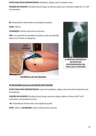 90
ESTRUTURAS MAIS DEMONSTRADAS: Acetábulo, cabeça, colo e trocânter maior.
POSIÇÃO DO PACIENTE: Decúbito dorsal, braços ao lado do corpo com o membro rodado de 15° a 20°
internamente.
RC: Perpendicular direcionado a articulação do quadril.
DFOFI: 100 cm.
COLIMAÇÃO: Colimar toda área de interesse.
OBS.: Se o paciente for portador de prótese, toda sua extensão
deverá ser incluída na radiografia.
AP DO QUADRIL (perna de rã)-ESPECIAL SEM TRAUMA
ESTRUTURAS MAIS DEMONSTRADAS: Lateral do acetábulo, cabeça, colo e área dos trocânteres sem
traumatismo.
POSIÇÃO DO PACIENTE: Decúbito dorsal, braços acima da cabeça, abduzir o fêmur de 40° a 45°
colocando o colo paralelo ao chassi.
RC: Perpendicular direcionado a articulação do quadril.
DFOFI: 100 cm; COLIMAÇÃO: Colimar toda área de interesse.
 