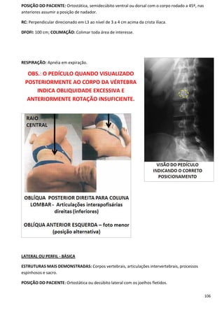 106
POSIÇÃO DO PACIENTE: Ortostática, semidecúbito ventral ou dorsal com o corpo rodado a 45º, nas
anteriores assumir a posição de nadador.
RC: Perpendicular direcionado em L3 ao nível de 3 a 4 cm acima da crista ilíaca.
DFOFI: 100 cm; COLIMAÇÃO: Colimar toda área de interesse.
RESPIRAÇÃO: Apnéia em expiração.
OBS.: O PEDÍCULO QUANDO VISUALIZADO
POSTERIORMENTE AO CORPO DA VÉRTEBRA
INDICA OBLIQUIDADE EXCESSIVA E
ANTERIORMENTE ROTAÇÃO INSUFICIENTE.
LATERAL OU PERFIL - BÁSICA
ESTRUTURAS MAIS DEMONSTRADAS: Corpos vertebrais, articulações intervertebrais, processos
espinhosos e sacro.
POSIÇÃO DO PACIENTE: Ortostática ou decúbito lateral com os joelhos fletidos.
 