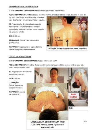 116
OBLÍQUA ANTERIOR DIREITA - BÁSICA
ESTRUTURAS MAIS DEMONSTRADAS: Esterno superposto a área cardíaca.
POSIÇÃO DO PACIENTE: Ortostática ou decúbito ventral, braços ao lado do corpo, paciente rodado de
15° a 20° com o lado direito tocando o bucky e
topo do chassi a 4 cm acima da incisura jugular.
RC: Perpendicular direcionado a um ponto
médio entre a coluna vertebral e a lateral
esquerda do paciente e entre a incisura jugular
e o apêndice xifóide.
DFOFI:100 cm.
COLIMAÇÃO: Colimar rigorosamente os
quatros lados.
RESPIRAÇÃO: Expor durante expiração lenta
com técnica para o melhor detalhe.
LATERAL OU PERFIL – BÁSICA
ESTRUTURAS MAIS DEMONSTRADAS: Todo o esterno em perfil.
POSIÇÃO DO PACIENTE: Decúbito dorsal com RC horizontal ou ortostática com os ombros para trás
com a lateral contra o filme.
RC: Perpendicular direcionado
ao meio do esterno.
DFOFI: 180 cm.
COLIMAÇÃO:
Colimar os quatros
lados de interesse.
RESPIRAÇÃO: Apnéia
em inspiração.
 