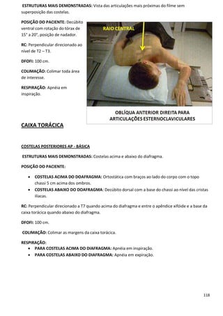118
ESTRUTURAS MAIS DEMONSTRADAS: Vista das articulações mais próximas do filme sem
superposição das costelas.
POSIÇÃO DO PACIENTE: Decúbito
ventral com rotação do tórax de
15° a 20°, posição de nadador.
RC: Perpendicular direcionado ao
nível de T2 – T3.
DFOFI: 100 cm.
COLIMAÇÃO: Colimar toda área
de interesse.
RESPIRAÇÃO: Apnéia em
inspiração.
CAIXA TORÁCICA
COSTELAS POSTERIORES AP - BÁSICA
ESTRUTURAS MAIS DEMONSTRADAS: Costelas acima e abaixo do diafragma.
POSIÇÃO DO PACIENTE:
 COSTELAS ACIMA DO DOAFRAGMA: Ortostática com braços ao lado do corpo com o topo
chassi 5 cm acima dos ombros.
 COSTELAS ABAIXO DO DOAFRAGMA: Decúbito dorsal com a base do chassi ao nível das cristas
ilíacas.
RC: Perpendicular direcionado a T7 quando acima do diafragma e entre o apêndice xifóide e a base da
caixa torácica quando abaixo do diafragma.
DFOFI: 100 cm.
COLIMAÇÃO: Colimar as margens da caixa torácica.
RESPIRAÇÃO:
 PARA COSTELAS ACIMA DO DIAFRAGMA: Apnéia em inspiração.
 PARA COSTELAS ABAIXO DO DIAFRAGMA: Apnéia em expiração.
 