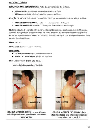 120
ANTERIORES - BÁSICA
ESTRUTURAS MAIS DEMONSTRADAS: Vistas das curvas laterais das costelas.
 Oblíquas posteriores: o lado afetado fica próximo ao filme.
 Oblíquas anteriores: o lado afetado fica afastado do filme.
POSIÇÃO DO PACIENTE: Ortostática ou decúbito com o paciente rodado a 45° em relação ao filme.
 PACIENTE EM ORTOSTÁTICA: Lesão em costelas acima do diafragma;
 PACIENTE EM DECÚBITO DORSAL: Lesão para costelas abaixo do diafragma.
RC: Perpendicular direcionado entre a margem lateral do paciente e a coluna ao nível de T7 quando
acima do diafragma com o topo do filme 5 cm acima do ombro e a meio caminho entre o apêndice
xifóide e a parte inferior da caixa torácica quando abaixo do diafragma com a margem inferior do filme
ao nível das cristas ilíacas.
DFOFI:100 cm.
COLIMAÇÃO: Colimar as bordas do filme.
RESPIRAÇÃO:
 ACIMA DO DIAFRAGMA: Apnéia em inspiração.
 ABAIXO DO DIAFRAGMA: Apnéia em expiração.
Obs:. Lesões do lado direito OPD e OAE.
Lesões do lado esquerdo OPE e OAD.
 