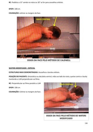 130
RC: Podálico a 15° saindo no násio ou 30° se for para assoalhos orbitais.
DFOFI: 100 cm.
COLIMAÇÃO: colimar as margens da face.
WATERS MODIFICADO - ESPECIAL
ESTRUTURAS MAIS DEMONSTRADAS: Assoalhos e bordas orbitais.
POSIÇÃO DO PACIENTE: Ortostática ou decúbito ventral, mãos ao lado do rosto, queixo contra o bucky
mantendo a LLM perpendicular ao filme.
RC: Perpendicular ao filme paralelo a LLM
DFOFI: 100 cm.
COLIMAÇÃO: Colimar as margens da face.
 