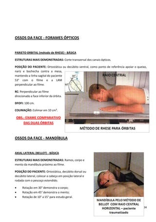 134
OSSOS DA FACE - FORAMES ÓPTICOS
PARIETO ORBITAL (método de RHESE) - BÁSICA
ESTRUTURAS MAIS DEMONSTRADAS: Corte transversal dos canais ópticos.
POSIÇÃO DO PACIENTE: Ortostática ou decúbito ventral, como ponto de referência apoiar o queixo,
nariz e bochecha contra a mesa,
mantendo a linha sagital do paciente
53° com o filme e a LAM
perpendicular ao filme.
RC: Perpendicular ao filme
direcionado a face inferior da órbita.
DFOFI: 100 cm.
COLIMAÇÃO: Colimar em 10 cm².
OBS.: EXAME COMPARATIVO
DAS DUAS ÓRBITAS
OSSOS DA FACE - MANDÍBULA
AXIAL LATERAL (BELLOT) - BÁSICA
ESTRUTURAS MAIS DEMONSTRADAS: Ramos, corpo e
mento da mandíbula próximo ao filme.
POSIÇÃO DO PACIENTE: Ortostática, decúbito dorsal ou
decúbito lateral, colocar a cabeça em posição lateral e
rodada com o pescoço estendido.
 Rotação em 30° demonstra o corpo;
 Rotação em 45° demonstra o mento;
 Rotação de 10° a 15° para estudo geral.
 
