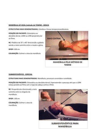 136
MANDÍBULA AP AXIAL (método de TOWNE) - BÁSICA
ESTRUTUTRAS MAIS DEMONSTRADAS: Côndilos e fossas temporomandibulares.
POSIÇÃO DO PACIENTE: Ortostática ou
decúbito dorsal, LIOM ou LOM perpendicular
ao filme.
RC: Podálico de 35° a 40° direcionado a glabela
saindo a meio caminho entre o meato e gônio.
DFOFI :100 cm.
COLIMAÇÃO: Colimar a área da mandíbula.
SUBMENTOVÉRTICE - ESPECIAL
ESTRUTURAS MAIS DEMONSTRADAS: Mandíbula, processos coronóide e condilóide.
POSIÇÃO DO PACIENTE: Ortostática ou decúbito dorsal, hiperextender o pescoço até que a LIOM
esteja paralela ao filme com o topo da cabeça contra o filme.
RC: Perpendicular direcionado a meio
caminho entre os ângulos da
mandíbula.
DFOFI: 100 cm.
COLIMAÇÃO: Colimar a área da
mandíbula.
 