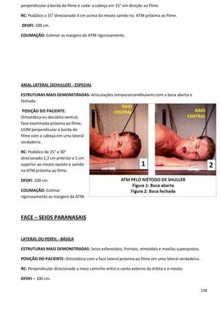 138
perpendicular à borda do filme e rodar a cabeça em 15° em direção ao filme.
RC: Podálico a 15° direcionado 4 cm acima do meato saindo na ATM próxima ao filme.
DFOFI: 100 cm.
COLIMAÇÃO: Colimar as margens da ATM rigorosamente.
AXIAL LATERAL (SCHULLER) - ESPECIAL
ESTRUTURAS MAIS DEMONSTRADAS: Articulações temporomandibulares com a boca aberta e
fechada.
POSIÇÃO DO PACIENTE:
Ortostática ou decúbito ventral,
face examinada próxima ao filme,
LIOM perpendicular a borda do
filme com a cabeça em uma lateral
verdadeira.
RC: Podálico de 25° a 30°
direcionado 1,3 cm anterior e 5 cm
superior ao meato oposto e saindo
na ATM próxima ao filme.
DFOFI: 100 cm.
COLIMAÇÃO: Colimar
rigorosamente as margens da ATM.
FACE – SEIOS PARANASAIS
LATERAL OU PERFIL - BÁSICA
ESTRUTURAS MAIS DEMONSTRADAS: Seios esfenoidais, frontais, etmoidais e maxilas superpostos.
POSIÇÃO DO PACIENTE: Ortostática com a face lateral próxima ao filme em uma lateral verdadeira.
RC: Perpendicular direcionado a meio caminho entre o canto externo da órbita e o meato.
DFOFI – 100 cm.
 