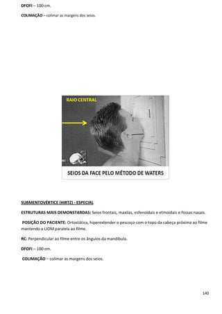 140
DFOFI – 100 cm.
COLIMAÇÃO – colimar as margens dos seios.
SUBMENTOVÉRTICE (HIRTZ) - ESPECIAL
ESTRUTURAS MAIS DEMONSTARDAS: Seios frontais, maxilas, esfenoidais e etmoidais e fossas nasais.
POSIÇÃO DO PACIENTE: Ortostática, hiperextender o pescoço com o topo da cabeça próxima ao filme
mantendo a LIOM paralela ao filme.
RC: Perpendicular ao filme entre os ângulos da mandíbula.
DFOFI – 100 cm.
COLIMAÇÃO – colimar as margens dos seios.
 