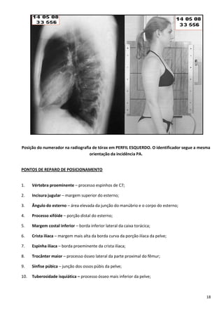 18
Posição do numerador na radiografia de tórax em PERFIL ESQUERDO. O identificador segue a mesma
orientação da incidência PA.
PONTOS DE REPARO DE POSICIONAMENTO
1. Vértebra proeminente – processo espinhos de C7;
2. Incisura jugular – margem superior do esterno;
3. Ângulo do esterno – área elevada da junção do manúbrio e o corpo do esterno;
4. Processo xifóide – porção distal do esterno;
5. Margem costal inferior – borda inferior lateral da caixa torácica;
6. Crista ilíaca – margem mais alta da borda curva da porção ilíaca da pelve;
7. Espinha ilíaca – borda proeminente da crista ilíaca;
8. Trocânter maior – processo ósseo lateral da parte proximal do fêmur;
9. Sínfise púbica – junção dos ossos púbis da pelve;
10. Tuberosidade isquiática – processo ósseo mais inferior da pelve;
 