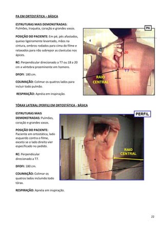 22
PA EM ORTOSTÁTICA – BÁSICA
ESTRUTURAS MAIS DEMONSTRADAS:
Pulmões, traquéia, coração e grandes vasos.
POSIÇÃO DO PACIENTE: Em pé, pés afastados,
queixo ligeiramente levantado, mãos na
cintura, ombros rodados para cima do filme e
relaxados para não sobrepor as clavículas nos
ápices.
RC: Perpendicular direcionado a T7 ou 18 a 20
cm a vértebra proeminente em homens.
DFOFI: 180 cm.
COLIMAÇÃO: Colimar os quatros lados para
incluir todo pulmão.
RESPIRAÇÃO: Apnéia em inspiração.
TÓRAX LATERAL (PERFIL) EM ORTOSTÁTICA - BÁSICA
ESTRUTURAS MAIS
DEMONSTRADAS: Pulmões,
coração e grandes vasos.
POSIÇÃO DO PACIENTE:
Paciente em ortostática, lado
esquerdo contra o filme,
exceto se o lado direito vier
especificado no pedido.
RC: Perpendicular
direcionado a T7.
DFOFI: 180 cm.
COLIMAÇÃO: Colimar os
quatros lados incluindo todo
tórax.
RESPIRAÇÃO: Apnéia em inspiração.
 