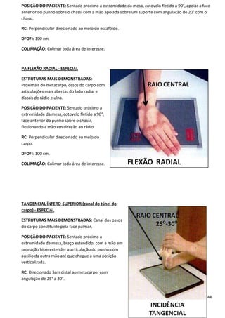 44
POSIÇÃO DO PACIENTE: Sentado próximo a extremidade da mesa, cotovelo fletido a 90°, apoiar a face
anterior do punho sobre o chassi com a mão apoiada sobre um suporte com angulação de 20° com o
chassi.
RC: Perpendicular direcionado ao meio do escafóide.
DFOFI: 100 cm
COLIMAÇÃO: Colimar toda área de interesse.
PA FLEXÃO RADIAL - ESPECIAL
ESTRUTURAS MAIS DEMONSTRADAS:
Proximais do metacarpo, ossos do carpo com
articulações mais abertas do lado radial e
distais de rádio e ulna.
POSIÇÃO DO PACIENTE: Sentado próximo a
extremidade da mesa, cotovelo fletido a 90°,
face anterior do punho sobre o chassi,
flexionando a mão em direção ao rádio.
RC: Perpendicular direcionado ao meio do
carpo.
DFOFI: 100 cm.
COLIMAÇÃO: Colimar toda área de interesse.
TANGENCIAL ÍNFERO-SUPERIOR (canal do túnel do
carpo) - ESPECIAL
ESTRUTURAS MAIS DEMONSTRADAS: Canal dos ossos
do carpo constituído pela face palmar.
POSIÇÃO DO PACIENTE: Sentado próximo a
extremidade da mesa, braço estendido, com a mão em
pronação hiperextender a articulação do punho com
auxilio da outra mão até que chegue a uma posição
verticalizada.
RC: Direcionado 3cm distal ao metacarpo, com
angulação de 25° a 30°.
 