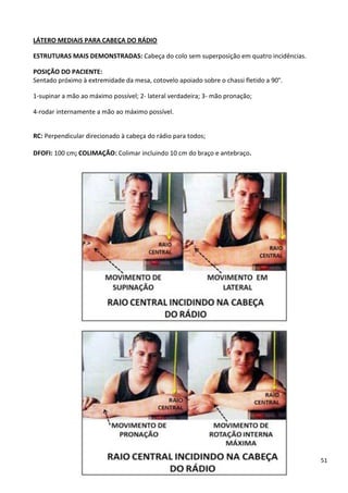 51
LÁTERO MEDIAIS PARA CABEÇA DO RÁDIO
ESTRUTURAS MAIS DEMONSTRADAS: Cabeça do colo sem superposição em quatro incidências.
POSIÇÃO DO PACIENTE:
Sentado próximo à extremidade da mesa, cotovelo apoiado sobre o chassi fletido a 90°.
1-supinar a mão ao máximo possível; 2- lateral verdadeira; 3- mão pronação;
4-rodar internamente a mão ao máximo possível.
RC: Perpendicular direcionado à cabeça do rádio para todos;
DFOFI: 100 cm; COLIMAÇÃO: Colimar incluindo 10 cm do braço e antebraço.
 