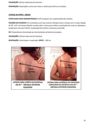 65
COLIMAÇÃO: Colimar toda área de interesse.
RESPIRAÇÃO: Respirações curtas sem mexer o ombro para borrar as costelas.
LATERAL OU PERFIL - BÁSICA
ESTRUTURAS MAIS DEMONSTRADAS: Perfil escapular sem superposição das costelas.
POSIÇÃO DO PACIENTE: Em ortostática com face anterior afetada contra o bucky com o corpo rodado
de 30° a 45° com braço afetado cruzado sobre o tórax para melhor visualização do corpo ou abaixado e
levado para trás para melhor visualização do acrômio e processo coracóide.
RC: Perpendicular direcionado ao meio da borda vertebral da escápula.
COLIMAÇÃO: Colimar toda área de interesse.
RESPIRAÇÃO: Interromper a respiração; DFOFI – 100 cm.
 