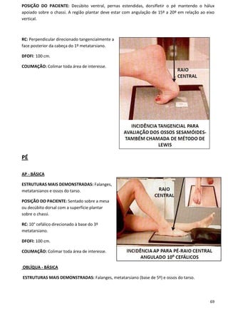 69
POSIÇÃO DO PACIENTE: Decúbito ventral, pernas estendidas, dorsifletir o pé mantendo o hálux
apoiado sobre o chassi. A região plantar deve estar com angulação de 15º a 20º em relação ao eixo
vertical.
RC: Perpendicular direcionado tangencialmente a
face posterior da cabeça do 1º metatarsiano.
DFOFI: 100 cm.
COLIMAÇÃO: Colimar toda área de interesse.
PÉ
AP - BÁSICA
ESTRUTURAS MAIS DEMONSTRADAS: Falanges,
metatarsianos e ossos do tarso.
POSIÇÃO DO PACIENTE: Sentado sobre a mesa
ou decúbito dorsal com a superfície plantar
sobre o chassi.
RC: 10° cefálico direcionado à base do 3º
metatarsiano.
DFOFI: 100 cm.
COLIMAÇÃO: Colimar toda área de interesse.
OBLÍQUA - BÁSICA
ESTRUTURAS MAIS DEMONSTRADAS: Falanges, metatarsiano (base de 5º) e ossos do tarso.
 