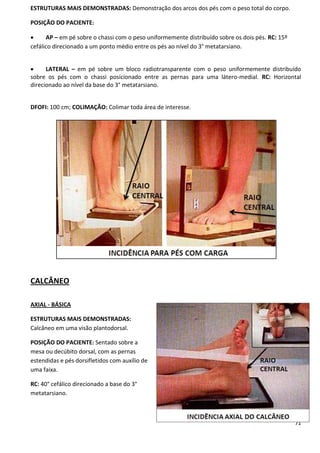 71
ESTRUTURAS MAIS DEMONSTRADAS: Demonstração dos arcos dos pés com o peso total do corpo.
POSIÇÃO DO PACIENTE:
 AP – em pé sobre o chassi com o peso uniformemente distribuído sobre os dois pés. RC: 15º
cefálico direcionado a um ponto médio entre os pés ao nível do 3° metatarsiano.
 LATERAL – em pé sobre um bloco radiotransparente com o peso uniformemente distribuído
sobre os pés com o chassi posicionado entre as pernas para uma látero-medial. RC: Horizontal
direcionado ao nível da base do 3° metatarsiano.
DFOFI: 100 cm; COLIMAÇÃO: Colimar toda área de interesse.
CALCÂNEO
AXIAL - BÁSICA
ESTRUTURAS MAIS DEMONSTRADAS:
Calcâneo em uma visão plantodorsal.
POSIÇÃO DO PACIENTE: Sentado sobre a
mesa ou decúbito dorsal, com as pernas
estendidas e pés dorsifletidos com auxílio de
uma faixa.
RC: 40° cefálico direcionado a base do 3°
metatarsiano.
 