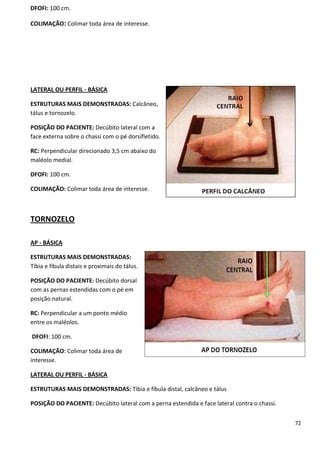 72
DFOFI: 100 cm.
COLIMAÇÃO: Colimar toda área de interesse.
LATERAL OU PERFIL - BÁSICA
ESTRUTURAS MAIS DEMONSTRADAS: Calcâneo,
tálus e tornozelo.
POSIÇÃO DO PACIENTE: Decúbito lateral com a
face externa sobre o chassi com o pé dorsifletido.
RC: Perpendicular direcionado 3,5 cm abaixo do
maléolo medial.
DFOFI: 100 cm.
COLIMAÇÃO: Colimar toda área de interesse.
TORNOZELO
AP - BÁSICA
ESTRUTURAS MAIS DEMONSTRADAS:
Tíbia e fíbula distais e proximais do tálus.
POSIÇÃO DO PACIENTE: Decúbito dorsal
com as pernas estendidas com o pé em
posição natural.
RC: Perpendicular a um ponto médio
entre os maléolos.
DFOFI: 100 cm.
COLIMAÇÃO: Colimar toda área de
interesse.
LATERAL OU PERFIL - BÁSICA
ESTRUTURAS MAIS DEMONSTRADAS: Tíbia e fíbula distal, calcâneo e tálus
POSIÇÃO DO PACIENTE: Decúbito lateral com a perna estendida e face lateral contra o chassi.
 