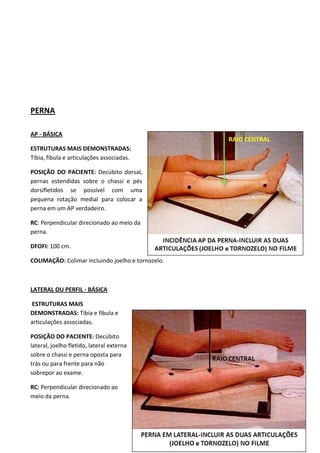 76
PERNA
AP - BÁSICA
ESTRUTURAS MAIS DEMONSTRADAS:
Tíbia, fíbula e articulações associadas.
POSIÇÃO DO PACIENTE: Decúbito dorsal,
pernas estendidas sobre o chassi e pés
dorsifletidos se possível com uma
pequena rotação medial para colocar a
perna em um AP verdadeiro.
RC: Perpendicular direcionado ao meio da
perna.
DFOFI: 100 cm.
COLIMAÇÃO: Colimar incluindo joelho e tornozelo.
LATERAL OU PERFIL - BÁSICA
ESTRUTURAS MAIS
DEMONSTRADAS: Tíbia e fíbula e
articulações associadas.
POSIÇÃO DO PACIENTE: Decúbito
lateral, joelho fletido, lateral externa
sobre o chassi e perna oposta para
trás ou para frente para não
sobrepor ao exame.
RC: Perpendicular direcionado ao
meio da perna.
 