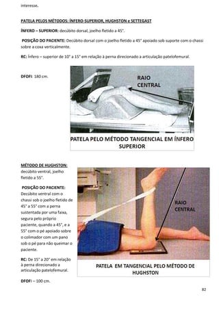 82
interesse.
PATELA PELOS MÉTODOS: ÍNFERO-SUPERIOR, HUGHSTON e SETTEGAST
ÍNFERO – SUPERIOR: decúbito dorsal, joelho fletido a 45°.
POSIÇÃO DO PACIENTE: Decúbito dorsal com o joelho fletido a 45° apoiado sob suporte com o chassi
sobre a coxa verticalmente.
RC: Ínfero – superior de 10° a 15° em relação à perna direcionado a articulação patelofemural.
DFOFI: 180 cm.
MÉTODO DE HUGHSTON:
decúbito ventral, joelho
fletido a 55°.
POSIÇÃO DO PACIENTE:
Decúbito ventral com o
chassi sob o joelho fletido de
45° a 55° com a perna
sustentada por uma faixa,
segura pelo próprio
paciente, quando a 45°, e a
55° com o pé apoiado sobre
o colimador com um pano
sob o pé para não queimar o
paciente.
RC: De 15° a 20° em relação
à perna direcionado a
articulação patelofemural.
DFOFI – 100 cm.
 
