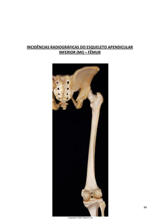 84
INCIDÊNCIAS RADIOGRÁFICAS DO ESQUELETO APENDICULAR
INFERIOR (MI) – FÊMUR
 