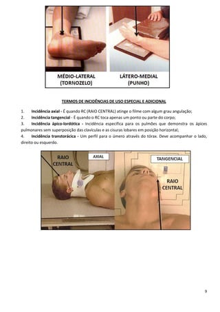 9
TERMOS DE INCIDÊNCIAS DE USO ESPECIAL E ADICIONAL
1. Incidência axial - É quando RC (RAIO CENTRAL) atinge o filme com algum grau angulação;
2. Incidência tangencial - É quando o RC toca apenas um ponto ou parte do corpo;
3. Incidência ápico-lordótica - Incidência específica para os pulmões que demonstra os ápices
pulmonares sem superposição das clavículas e as cisuras lobares em posição horizontal;
4. Incidência transtorácica - Um perfil para o úmero através do tórax. Deve acompanhar o lado,
direito ou esquerdo.
 
