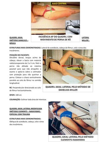 91
QUADRIL AXIAL LATERAL
(MÉTODO DANELIUS – MILLER) -
BÁSICA
ESTRUTURAS MAIS DEMONSTRADAS: Lateral do acetábulo, cabeça do fêmur, colo e área dos
trocânteres.
POSIÇÃO DO PACIENTE:
Decúbito dorsal, braços acima da
cabeça, elevar a bacia com material
radiotransparente de 3 a 5 cm, fletir a
perna não afetada ao máximo
possível para que não atrapalhe o
exame e apóia-la sobre o colimador
com proteção para não queimar a
perna. Colocar o chassi verticalmente
paralelo ao colo do fêmur no sentido
longitudinal.
RC: Perpendicular direcionado ao colo
de fêmur horizontalmente.
DFOFI: 100 cm
COLIMAÇÃO: Colimar toda área de interesse.
QUADRIL AXIAL LATERAL MODIFICADA
(MÉTODO CLEMENTS – NAKAYAMA) -
ESPECIAL COM TRAUMA
ESTRUTURAS MAIS DEMONSTRADAS:
Oblíqua do acetábulo, cabeça, colo e área
dos trocânteres.
 