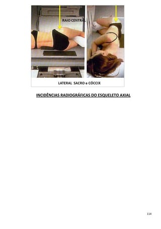 114
INCIDÊNCIAS RADIOGRÁFICAS DO ESQUELETO AXIAL
 