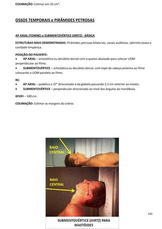 145
COLIMAÇÃO: Colimar em 10 cm².
OSSOS TEMPORAIS e PIRÂMIDES PETROSAS
AP AXIAL (TOWNE) e SUBMENTOVÉRTICE (HIRTZ) - BÁSICA
ESTRUTURAS MAIS DEMONSTRADAS: Pirâmides petrosas bilaterais, canais auditivos, labirinto ósseo e
cavidade timpânica.
POSIÇÃO DO PACIENTE:
 AP AXIAL – ortostática ou decúbito dorsal com o queixo abaixado para colocar LIOM
perpendicular ao filme;
 SUBMENTOVÉRTICE – ortostática ou decúbito dorsal, com topo da cabeça próxima ao filme
colocando a LIOM paralela ao filme.
RC:
 AP AXIAL – podálico a 37° direcionado à da glabela passando 2,5 cm anterior ao meato;
 SUBMENTOVÉRTICE – perpendicular direcionado ao nível dos ângulos da mandíbula.
DFOFI – 100 cm.
COLIMAÇÃO: Colimar as margens do crânio.
 