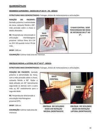 34
QUIRODÁTILOS
MEMBROS SUPERIORES - DEDOS DO 2º AO 5º - PA - BÁSICA
ESTRUTURAS MAIS DEMONSTRADAS: Falanges, distais de metacarpianos e articulações.
POSIÇÃO DO PACIENTE:
Sentado próximo á extremidade
da mesa, cotovelo fletido a 90°,
mão pronada sobre o chassi e
dedos afastados.
RC: Perpendicular direcionado à
articulação interfalangiana
proximal. Utilizar filme 18 X 24
ou 24 X 30 quando incluir PA de
mão.
DFOFI: 100 cm.
COLIMAÇÃO: Colimar toda área de interesse.
OBLÍQUAS MEDIAL e LATERAL DO 2⁰ AO 5⁰ - BÁSICA
ESTRUTURAS MAIS DEMONSTRADAS: Falanges, distais de metacarpianos e articulações.
POSIÇÃO DO PACIENTE: Sentado
próximo à extremidade da mesa,
com a mão pronada sobre o chassi,
cotovelo fletido a 90°. Rodar o
dedo afetado em 45° lateralmente
segurando os demais com a outra
mão ou 45° medialmente para o
segundo dedo.
RC: Perpendicular direcionado à
articulação interfalangiana
proximal (IFP).
DFOFI: 100 cm.
COLIMAÇÃO: Colimar toda área de
interesse.
 